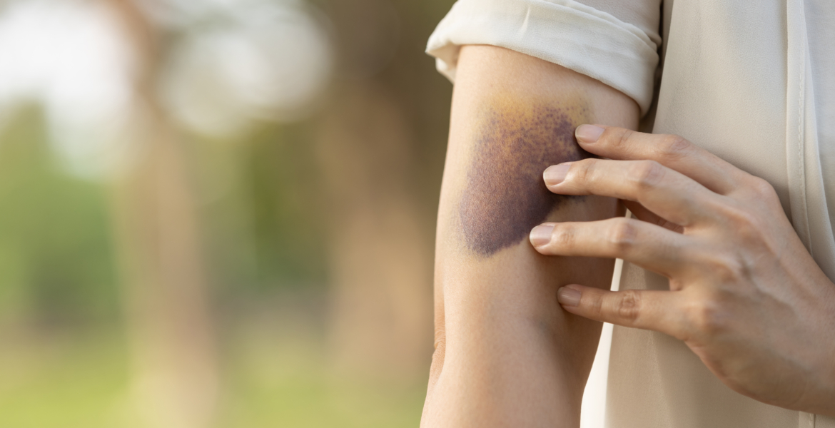 وزارة الصحة تخلد اليوم العالمي لهيموفيليا تحت شعار “الأمراض النزفية: الولوج للجميع الوقاية من النزيف كمعيار عالمي للرعاية”