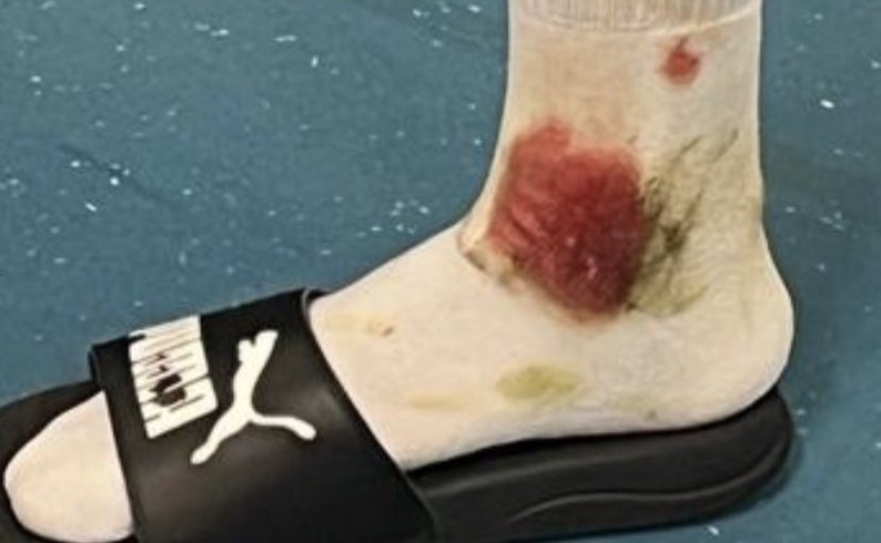 تعرض أمين حارث لتدخل رهيب يثير غضب جماهير أولمبيك مرسيليا