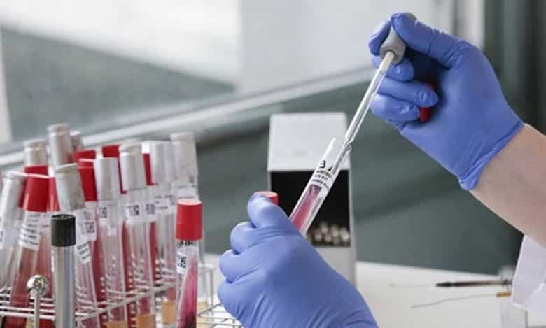 الأمانة العامة للحكومة تسلم 1779 رخصة لفتح مختبرات التحاليل البيوليوجية