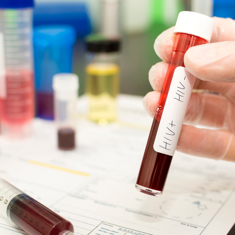 تخفيض التمويل الأمريكي يهدد حياة الملايين بسبب الإيدز